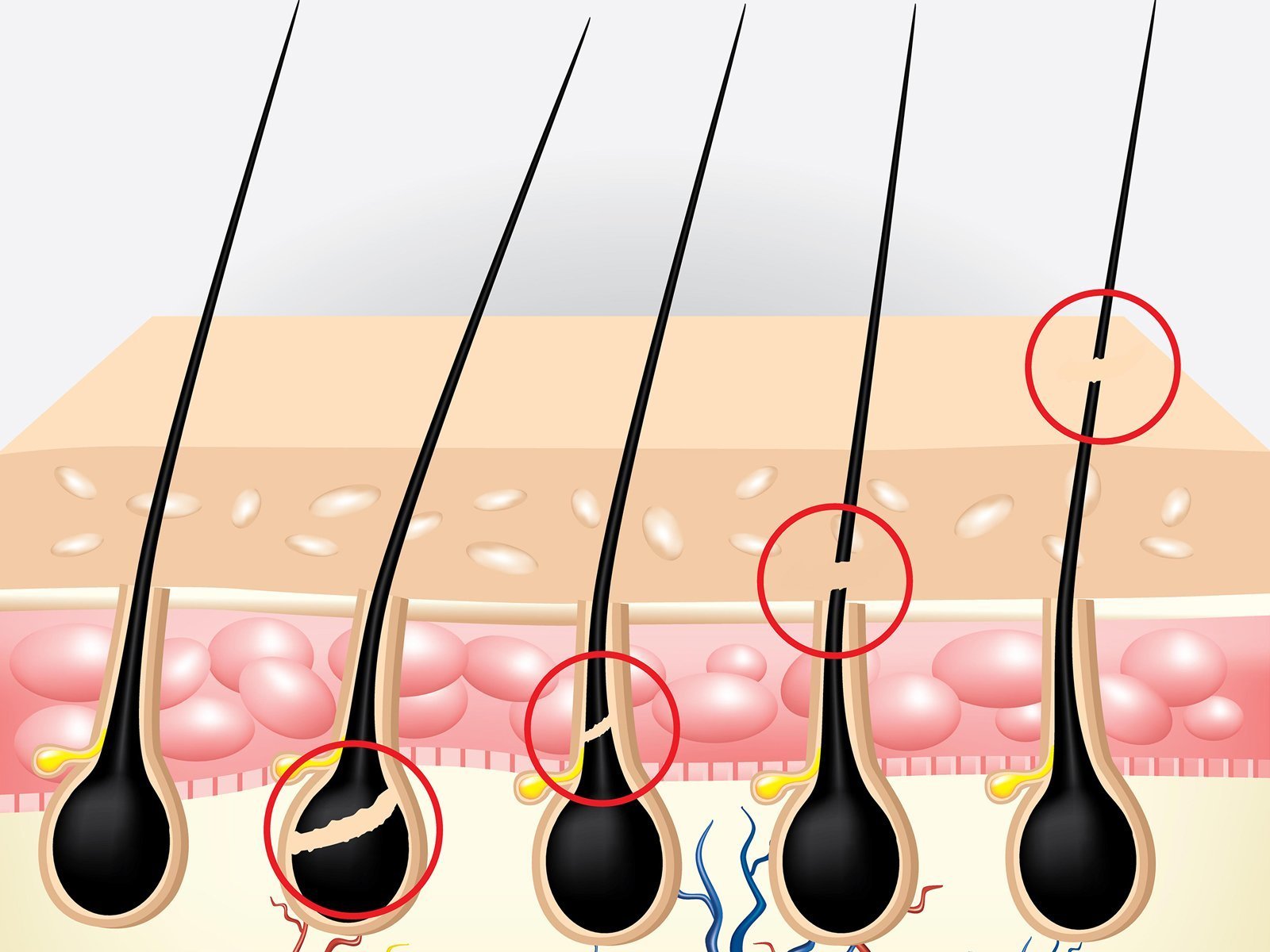 Reducing Breakages